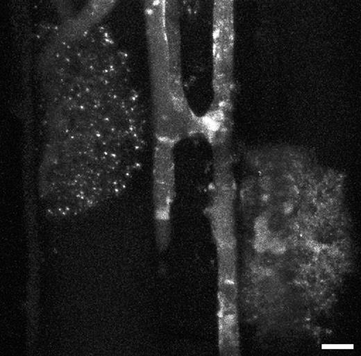 Glomus mosseae in mycorrhizal roots of Allium porrum. Two arbuscules and two running hyphae connected by an anastomosis are shown. The brightly fluorescing globular and tubular structures within the hyphae are probably vacuoles. The staining solution was 0·4 μm NR in 10 mm MOPS/KOH-buffer, pH 8·0. Projection of 63 optical sections, each covers 116 μm2, total thickness of tissues scanned is 28 μm. Scale bar = 10 μm.