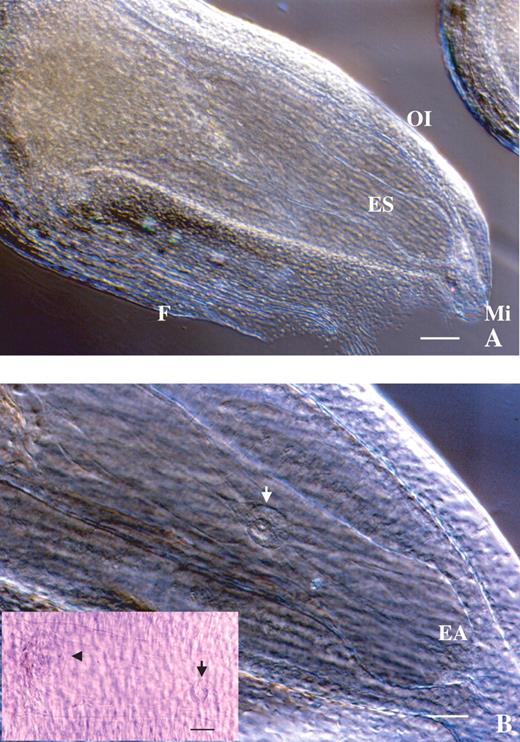 Microscopic observation of an Alstroemeria ovule using the clearing procedure. (A) Whole ovule showing the large embryo sac within. ES, Embryo sac; F, funicle; OI, outer integument; Mi, micropyle. Scale bar = 120 μm. (B) Magnification of the inside of an ovule. The egg apparatus (EA) and fused polar nuclei (white and black arrows) are in focus. The antipodal cells (arrowhead) are also observed in the left of the frame. Scale bar = 60 μm.
