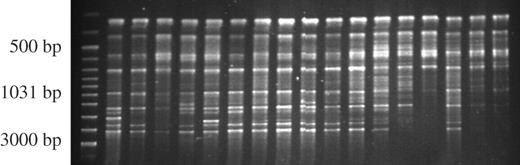 Electrophoresis of PCR products amplified with primer UBC # 857 for the Ninglang population.