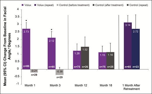 Change from baseline in glabella-subnasale-pogonion angle before and after treatment with Volux. aA positive value indicates an increase in projection of the chin and/or jaw.