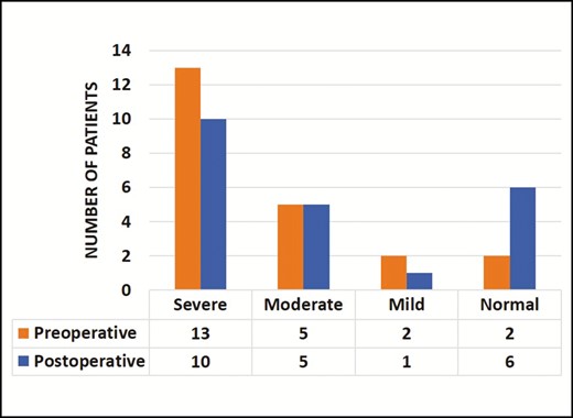 Change in the number of patients in each Ocular Surface Disease Index category. Although the overall postoperative severity based on the Ocular Surface Disease Index score tends to decrease, the difference was not significant (P > 0.05 by linear-by-linear association chi-square test).