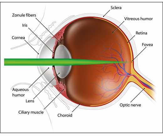 A cross-sectional image of a laser beam entering the eye. As the eye attempts to focus the image, radiant energy is amplified approximately 100 times. The type of optical injury is dependent upon the wavelength of laser radiation.