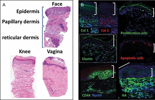 Examples of skin regeneration markers. (A) Hematoxylin and eosin staining of various skin and mucosa microbiopsies. (B) Immunofluorescence staining (green and red) of abdominal skin biopsies counter stained against nuclear marker DAPI (blue). apoptotic cells, TUNEL staining; Col 1, collagen I; Col 2, collagen 2; Elastin, CD44; HA, hyaluronic acid or hyaluronan; proliferative cells, Ki67 staining. White brackets indicate epidermis.