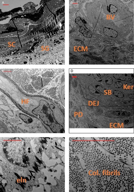 Transmission electron microscopy scanning of various regions and structures in a facial skin biopsy preparation, including epidermis (A), blood vessel (B), hair follicle (C), epidermal dermal junction (D), elastin (E), and collagen (F). Scale bars in red represents 2 µm. BV, blood vessel; col, collagen; DEJ, dermal epidermal junction; ECM, extracellular matrix; eln, elastin fibrils; Fb, fibroblast; HF, hair follicle; Ker, keratinocyte; PD, papillary dermis or subepidermis; SB, stratum basale; SC, stratum corneum; SG, stratum granulosum.