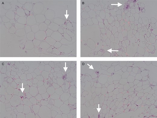 Hematoxylin-eosin staining of paraffin sections of lipoaspirates. Control group (A), Telfa group (B), Coleman group (C), and P2S group (D). Arrow, fibrous connective tissue. Scale bar, 50 μm.
