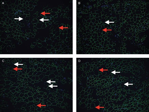 Immunofluorescence of specimens. Control group (A), Telfa group (B), Coleman group (C), and P2S group (D). White arrow, fragmentary adipocyte; red arrow, weakly perilipin-positive adipocyte. Scale bar, 50 μm.