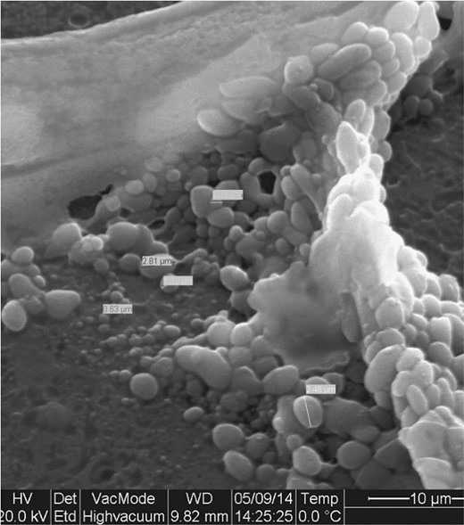 Heterogeneity of bacteria size. This indicates different phenotypes, and therefore different invasive properties and antibiotic resistance.