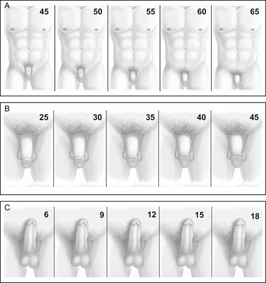 (A) Varying positions of the penis on the torso. Numbers in the upper right corner represent the ratio of the umbilicus to shaft distance divided by the jugular notch to umbilicus distance. Note: numbers were not present on photographs sent to survey respondents. All numbers represent a percentage. (B) Varying dorsal glans ratios. Numbers in the upper right corner represent the ratio of the dorsal glans length divided by the total externally visible penile length. Note: numbers were not present on photographs sent to survey respondents. All numbers represent a percentage. (C) Varying ventral glans ratios. Numbers in the upper right corner represent the ratio of the ventral glans length divided by the total externally visible penile length. Note: numbers were not present on photographs sent to survey respondents. All numbers represent a percentage.
