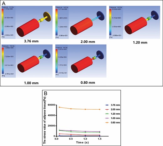 Finite element method results for the shuffling model. (A) Cloud map of stress distribution of adipose tissue in different converters and parts at 0.5 seconds. (B) Stress value in the 3.76-mm, 2.00-mm, 1.20-mm, 1.00-mm, and 0.80-mm converter group (Pa) at different times.