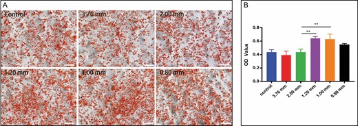Adipogenic differentiation ability of stromal vascular fraction induced in AdipoDiff medium for 2 weeks. (A) Photomicrographs of 6 samples of stromal vascular fraction cells stained with oil red O (50×). (B) Absorbance optical density value of each group at a 520-nm wavelength (**P < 0.01).