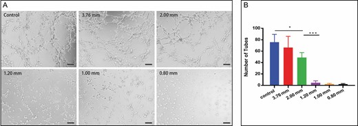 Angiogenic activities of stromal vascular fraction in vitro. (A) Photomicrograph of the differentiated stromal vascular fraction cells demonstrating tube network formation on matrigel (200×). (B) Quantification of total number of network tubules (*P < 0.05, ***P < 0.001).