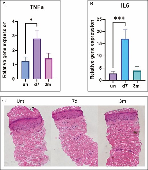 (A-C) Gene expression of the inflammatory markers TNFα and IL-6. Hemotoxylin-eosin staining of microbiopsy sections at baseline (untreated), and at 7 days and 3 months posttreatment. *P < 0.05, ***P < 0.001 vs untreated skin or baseline. d, day; m, month; unt, untreated; IL, interleukin; TNFα, tumor necrosis factor α.