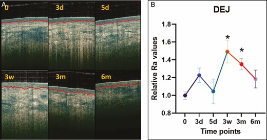 The dermal-epidermal junction assessed from optical coherence tomography images (A) and charted as relative Ra value demonstrating the roughness at 7 days, 3 weeks, 3 months, and 6 months posttreatment (B). *P < 0.05 vs untreated skin or baseline. d, day; m, month; w, week.