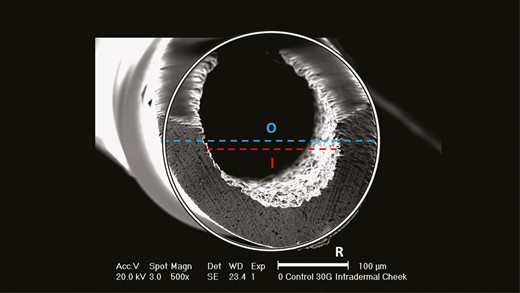 Needle surface area calculation based on the inner (I) and outer (O) diameters.