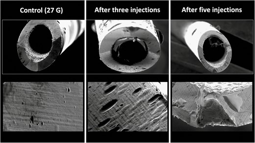 Deformational changes of a 27G needle after 3 and 5 injections into the zygomatic area with bony contact. The control image was taken prior to any injection. Note the smooth surface of the control needle on the left in comparison to the rougher texture and deformation of the needle tips after use.