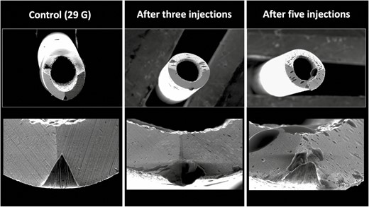 Deformational changes of a 29G needle after 3 and 5 supraperiosteal injections into the tear trough region. The control image was taken prior to any injection. Note the smooth surface of the control needle on the left in comparison to the rougher texture and deformation of the needle tips after use.