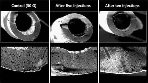 Deformational changes of a 30G needle after 5 and 10 subdermal injections into the cheek. The control image was taken prior to any injection. Note the smooth surface of the control needle on the left in comparison to the rougher texture and deformation of the needle tips after use.