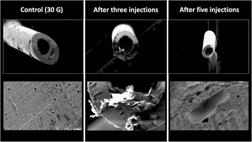Deformational changes of a 30G needle after 3 and 5 intradermal injections into the nasolabial fold. The control image was taken prior to any injection. Note the smooth surface of the control needle on the left in comparison to the rougher texture and deformation of the needle tips after use.