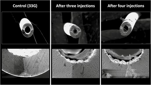 Deformational changes of a 33G needle after 3 and 4 intradermal injections into the cutaneous upper lip. The control image was taken prior to any injection. Note the smooth surface of the control needle on the left in comparison to the rougher texture and deformation of the needle tips after use.