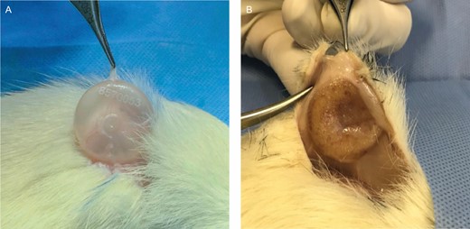(A) A nanotextured explant not adhered to the adjacent tissue. Note the thickness of the nanotextured implant capsule on the clamp. (B) A polyurethane foam–covered explant adhered to the adjacent tissue.