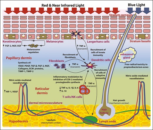 Diagrammatic summary of the effects of red/near-infrared and blue light on epidermis, dermis, sebaceous glands, hair follicles, and subcutaneous fat. ECM, extracellular matrix; EGF, epidermal growth factor; FGF-2, fibroblast growth factor 2; HIF-1, hypoxia-inducible factor 1; IL, interleukin; NGF, nerve growth factor; PDGF, platelet-derived growth factor; TIMP, tissue inhibitor of matrix metalloproteinase; TGF-β, transforming growth factor β; TNF-α: tissue necrosis factor α; VEGF, vascular endothelial growth factor.