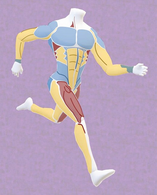 Color-based anatomic-topographic concept of variable degrees of dynamic definition according to the BMX (Basic, Moderate, eXtreme) algorithm (blue, basic; yellow, moderate; red, extreme).