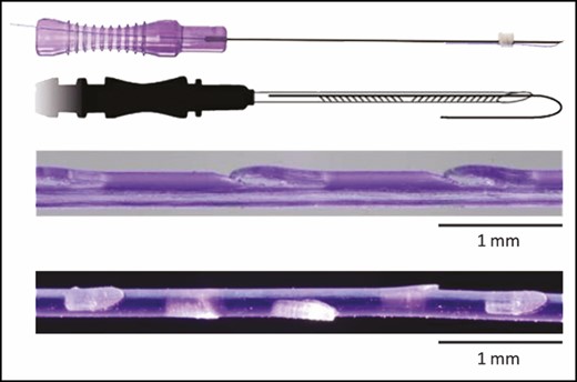 Photograph of the Barb II needle model, illustration of Barb II needle model, and microscopical photographs of the barbed suture for the needle (upper part) and the cannula (lower part) models (printed with permission of Croma-Pharma GmbH, Leobendorf, Austria).