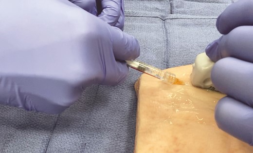 Single-handed aspiration test.