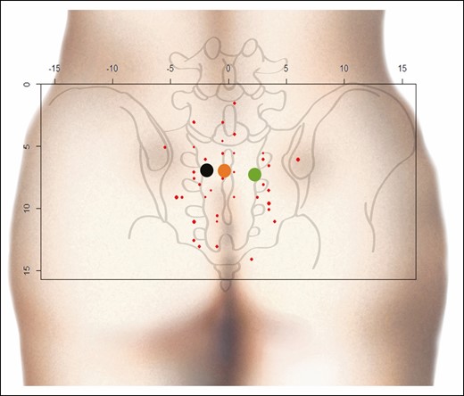 Point cloud. Red points, PSAP coordinates; black point, mean coordinates of the PSAP on the left side; green point, mean coordinates of PSAP on the right side; orange point: mean coordinates of all PSAPs. x and y axes in centimeters. PSAP, parasacral artery perforator.