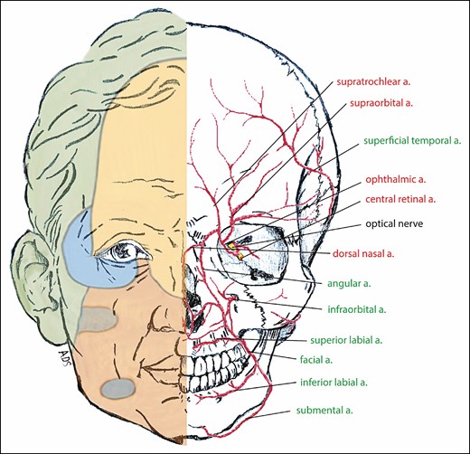 The right half of the face, illustrating the facial angiosomes and showing the internal carotid and ophthalmic arteries (yellow), the internal maxillary artery (blue), the facial artery (red), and the superficial temporal artery (green). The main branches of the ophthalmic artery (branch of the internal carotid artery) (red) and the external carotid artery (green) are shown on the left half of the face.