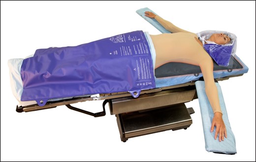 Three HotDog blankets. Note that we place the lower body blanket caudal to what is shown in this figure, extending from the lower third of the thigh to the ankle. Reprinted with permission from Augustine Surgical, Inc. (Eden Prairie, MN).