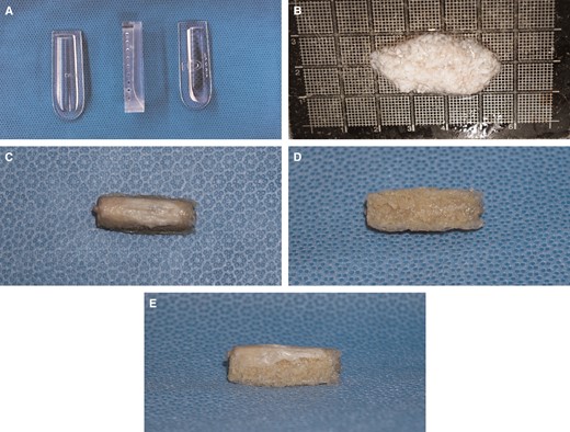 (A) Jang Cartilage Mold for dorsal augmentation with glued diced cartilage grafting (GDCG). Three different components (left to right: base template, guarding frame with side holes, and compressor with handle) make up the mold. (B) GDCG being prepared from costal cartilage. (C-E) GDCG dorsal implant prepared with Jang Cartilage Mold: (C) dorsal surface with covering fascia, (D) ventral surface, and (E) lateral view with covering fascia on dorsal surface.