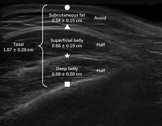 Overall thickness and recommended injection proportion of each layer. Circle, skin; triangle, masseter fascia; star, deep inferior tendon; square, mandible surface.