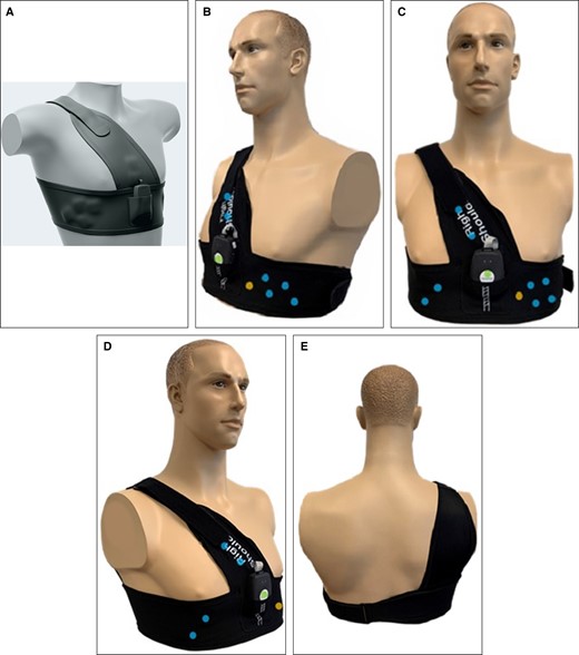 SimpleSense vest (Nanowear Technologies, Brooklyn, NY): (A) a 3-dimensional perspective drawing of the vest; (B-E) locations of the nanosensors and MEMS microphone and accelerometer in right (B), ventral (C), left (D), and dorsal (E) perspectives. Blue dot, cloth-based nanosensors; green dot, 3-axis MEMs accelerator in the SAU; yellow dot, MEMS microphone. MEMS, microelectromechanical systems.
