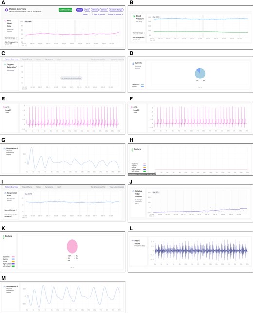 Screenshot of parameters captured on surgeon's iPhone application (Apple Inc., Cupertino, CA): (A) ECG-derived heart rate, (B) blood pressure, (C) oxygen saturation, (D) activity as a pie chart showing percentage of time active or sedentary, (E) vector 1 ECG, (F) vector 2 ECG, (G) vector 1 thoracic impedance, (H) posture over time as a line chart, (I) respiration rate, (J) relative tidal volume, (K) posture in each of 5 categories (sit/stand, supine, prone, right lateral, or left lateral), (L) heart sounds, and (M) vector 2 thoracic impedance. ECG, electrocardiogram.