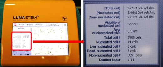 The screen shows all the data automatically calculated by the Luna-Stem Dual Fluorescence Cell Counter.