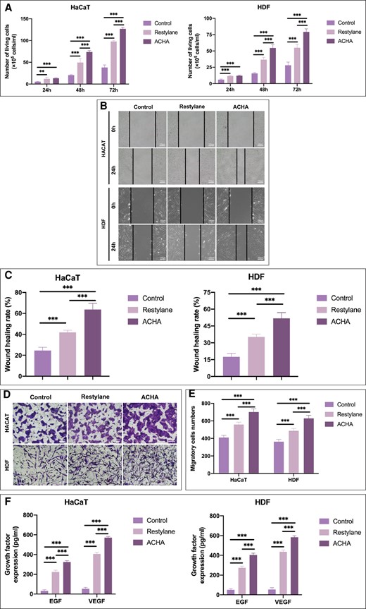 Comparison of cell viability and proliferation and secretion of growth factors after amino acid–cross-linked hyaluronic acid (ACHA) and Restylane treatment. (A) Human keratinocyte (HaCaT) and human dermal fibroblast (HDF) viability analysis in response to Restylane and ACHA as determined by Trypan blue staining. (B, C) Scratch wound assay analyzed the effects of ACHA and Restylane on the migration of HaCaT and HDF (scale bar = 100 μm). (D, E) Transwell experiments evaluated the effects of ACHA and Restylane on cell migratory ability (scale bar = 100 μm). (F) Enzyme-linked immunoassay (ELISA) of secreted EGF and VEGF in HaCaT and HDF cells. **P < .01, ***P < .001. h, hours. pg/ml, picograms/milliliter.