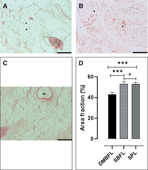 (A-C) The adipose tissue composition in hematoxylin and eosin–stained divisions of the suspensory ligament system of the penis. (A) The adipose tissue composition of the DMBFL. (B) The adipose tissue composition of the SBFL. (C) The adipose tissue composition of the SPL. (D) Bar graph showing the composition of the adipose tissue of each division of the suspensory ligament of the penis. ***Significant difference (P ≤ .05); #no significant difference (P ≥ .05). *Adipocytes. BV, blood vessels; DMBFL, deep median bundle of the fundiform ligament; SBFL, superficial bundle of the fundiform ligament; SPL, suspensory penile ligament. Scale bar =50 µm applies to (A-C).