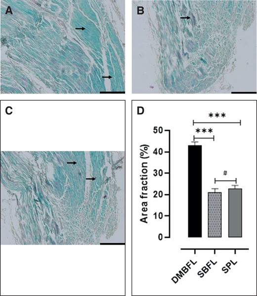(A-C) The collagen fiber composition of the Masson's trichrome–stained divisions of the suspensory ligament system of the penis. (A) The collagen fiber composition of the DMBFL. (B) The collagen fiber composition of the SBFL. (C) The collagen fiber composition of the SPL. (D) Bar graph showing the composition of the collagen fibers of each division of the suspensory ligament of the penis. ***Significant difference (P ≤ .05); #no significant difference (P ≥ .05). DMBFL, deep median bundle of the fundiform ligament; SBFL, superficial bundle of the fundiform ligament; SPL, suspensory penile ligament. Arrows = collagen fibers. Scale bar = 50 µm applies to (A-C).
