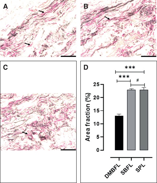 (A-C) The elastic fiber composition of the Verhoeff's elastic–stained divisions of the suspensory ligament system of the penis. (A) The elastic fiber composition of the DMBFL. (B) The elastic fiber composition of the SBFL. (C) The elastic fiber composition of the SPL. (D) Bar graph showing the composition of the elastic fibers of each division of the SPL. ***Significant difference (P ≤ .05); #no significant difference (P ≥ .05). DMBFL, deep median bundle of the fundiform ligament; SBFL, superficial bundle of the fundiform ligament; SPL, suspensory penile ligament Scale bar =50 µm applies to (A, B and C).