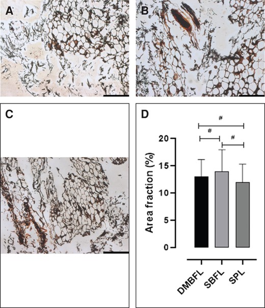 (A-C) The reticular fiber composition of the silver-stained divisions of the suspensory ligament system of the penis. (A) The reticular fiber composition of the DMBFL. (B) The reticular fiber composition of the SBFL. (C) The reticular fiber composition of the SPL. (D) Bar graph showing the composition of the reticular fibers of each division of the suspensory ligament of the penis. #No significant difference (P ≥ .05); *adipocytes within the meshwork of reticular fibers. DMBFL, deep median bundle of the fundiform ligament; SBFL, superficial bundle of the fundiform ligament; SPL, suspensory penile ligament. Scale bar = 50 µm applies to (A-C).