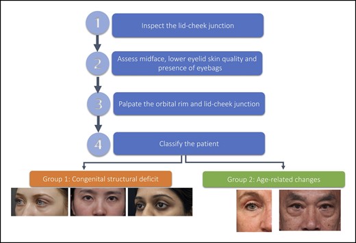 Lower eyelid dark circles: stepwise assessment framework.