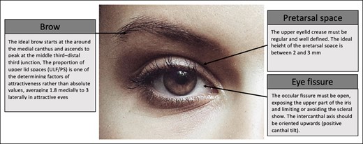 Anthropometric criteria for periorbital aesthetics depicted in a 24-year-old female patient.