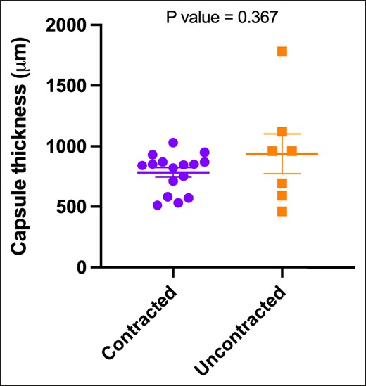 The median values of 5 distinct thickness measurements in micrometers (μm) were determined from hematoxylin and eosin–stained tissue sections obtained from both contracted and uncontracted capsules. The represented data are depicted as the median and standard deviation. Statistical analysis with the Mann–Whitney test yielded a P value of .367, indicating no significant difference between the 2 groups.