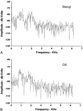 Example noise spectra from Stengl (A) and Gill (B) locations. Each is the FFT of a single 1-s sample.