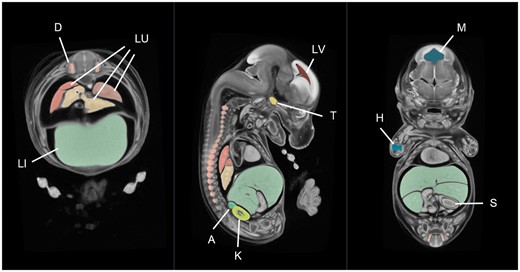 A mouse embryo atlas at E14.5 dpc. This atlas is an average of 16 micro-CT images of C57Bl/6N (wild-type) embryos produced using in-house software. The average was segmented in 3D Slicer using our WASP plug-in, taking ∼8 h in total. The organs shown in this figure include the liver (LI), lungs (LU), dorsal root ganglia (D), trigeminal ganglion (T), humerus primordium (H), kidney (K), adrenal gland (A), stomach lumen (S) lateral brain ventricle (LV) and mesencephalic vesicle (M).