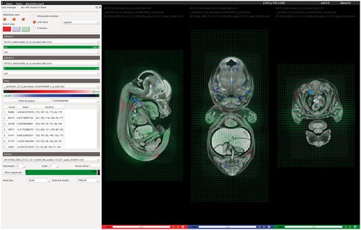 VPV is a desktop application for visualizing the results of 3D image registration. Designed to accompany the automated analysis pipeline, VPV brings together many of the most desirable features found across existing visualization tools into a simple, intuitive graphical user interface. The screenshot shows the software being used to view the results of analysing Cbx2 knockout embryos imaged by micro-CT. Users can simply drag and drop their images and analyse data to instantly view regions of significant dysmorphology as heatmaps, shown in red/blue overlays. Deformation (vector) fields can also be overlaid to observe how the registration has behaved, as shown in green.