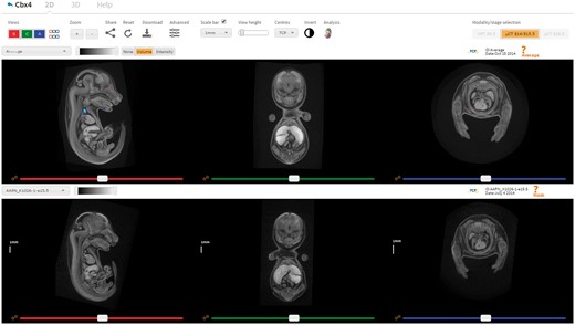 IEV is a web-based tool that allows users to directly compare wild-type and mutant embryos in a dynamic, intuitive manner. Users can navigate the volumes in synchrony by using the sliders, mouse wheel or crosshair tool (shift key while moving the mouse). The settings panel provides options to toggle viewports on/off, configure the scale bar, zoom in/out, create bookmarks and switch modality. Each viewer has its own drop-down box listing the embryos available to view, an image contrast slider, and the ability to link/unlink individual viewports. Other features include fully interactive 3D renderings, ability to bookmark viewer state and share them and full resolution downloads. Automated analysis results can also be displayed where available, as shown here in the top viewer for the gene Cbx4 (http://www.mousephenotype.org/embryoviewer/?mgi=MGI:1195985&wn=Average). Images and analysis results were produced by The Centre for Phenogenomics, Toronto. A user guide can be viewed and downloaded by clicking the Help tab.