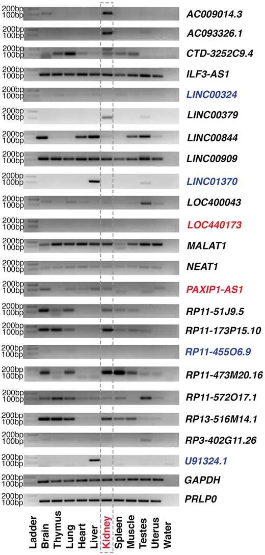 RT-PCR experiment of selected kidney-expressed lincRNAs. To be consistent, 35 cycles of PCR reactions were used for all primer pairs. GAPDH and PRLP0 were used as loading controls. Those lincRNAs whose expressions could not detected with 35 cycles of PCR reactions are marked in blue, while two lincRNAs used for further experiments are marked in red.
