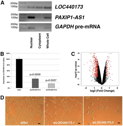 Expression of two selected lincRNAs and characterization of LOC440173. (A) Subcellular localization of LOC440173 and PAXIP1-AS1 in HEK-293 cells. For GAPDH, the primer pair targeting its intron between exon 2 and 3 was used. The representative image from three independent assays. (B) Efficiency of silencing by siRNAs; n = 3. (C) Volcano plot comparing silencing of LOC440173 and siScr. Genes selected above the threshold of 1.5-fold and p < 0.05 are colored in red; n = 2. (D) Morphologies of cells on siRNA transfection. The scale bar represents 100 μM.